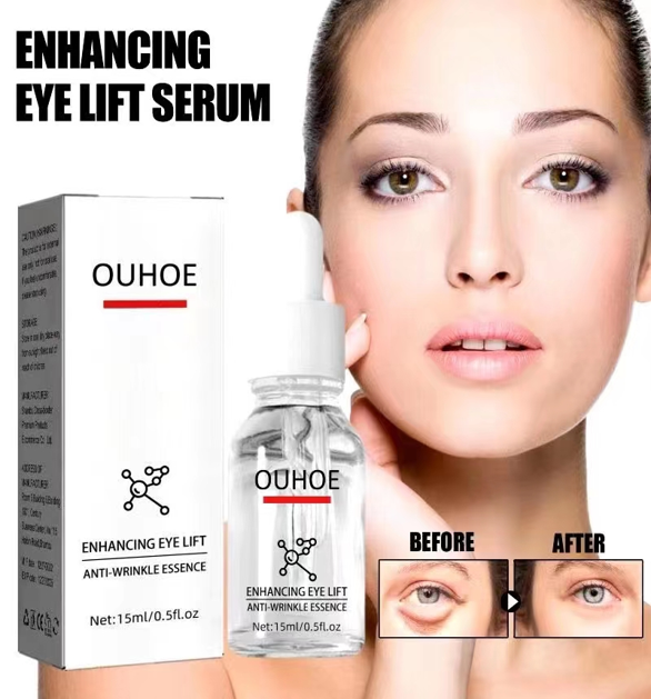 Serum quita Ojeras